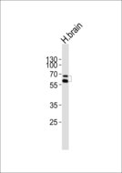 NR4A2 / NURR1 Antibody - Western blot of lysate from human brain tissue lysate, using NR4A2 antibody diluted at 1:1000. A goat anti-rabbit IgG H&L (HRP) at 1:10000 dilution was used as the secondary antibody. Lysate at 20 ug.