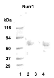 NR4A2 / NURR1 Antibody - Western blot detection of Nurr1 in 20 ug of human hippocampus tissue lysate (lanes 2 and 4) with Nurr1 polyclonal at 1:1000 dilution followed by AP-conjugated secondary at 1:5000 dilution. MW marker lane 1. Peptide absorption control lane 3.