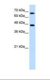 NR4A2 / NURR1 Antibody - Jurkat cell lysate. Antibody concentration: 0.25 ug/ml. Gel concentration: 12%.  This image was taken for the unconjugated form of this product. Other forms have not been tested.