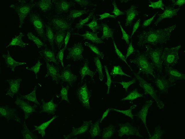 NR4A2 / NURR1 Antibody - Immunofluorescence staining of NR4A2 in Hela cells. Cells were fixed with 4% PFA, permeabilzed with 0.1% Triton X-100 in PBS, blocked with 10% serum, and incubated with rabbit anti-Human NR4A2 polyclonal antibody (dilution ratio 1:200) at 4°C overnight. Then cells were stained with the Alexa Fluor 488-conjugated Goat Anti-rabbit IgG secondary antibody (green). Positive staining was localized to Nucleus and cytoplasm.