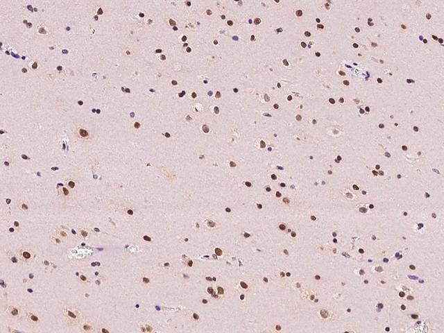 NR4A2 / NURR1 Antibody - Immunochemical staining of human NR4A2 in human brain with rabbit polyclonal antibody at 1:100 dilution, formalin-fixed paraffin embedded sections.