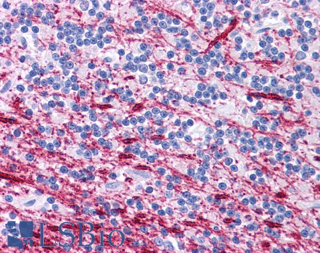 NR4A2 / NURR1 Antibody - Human Brain, Cerebellum: Formalin-Fixed, Paraffin-Embedded (FFPE).  This image was taken for the unconjugated form of this product. Other forms have not been tested.