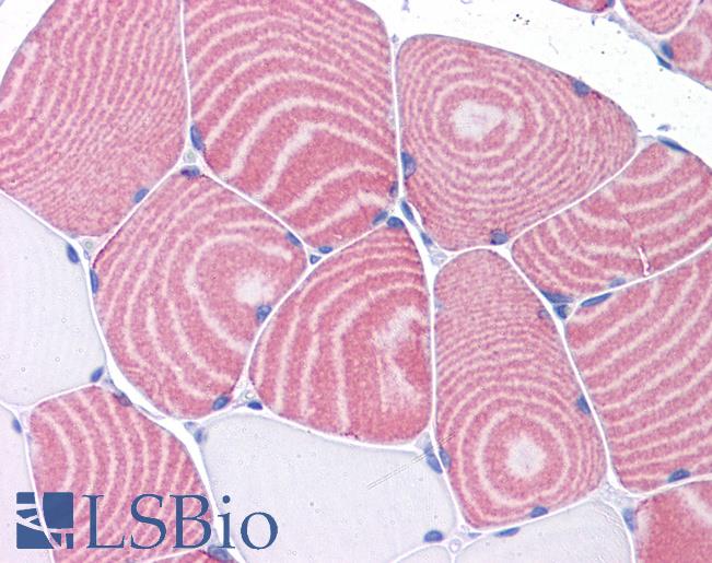NR4A2 / NURR1 Antibody - Human Skeletal Muscle: Formalin-Fixed, Paraffin-Embedded (FFPE).  This image was taken for the unconjugated form of this product. Other forms have not been tested.