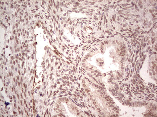 NR5A1 / SF1 Antibody - Immunohistochemical staining of paraffin-embedded Human endometrium tissue within the normal limits using anti-NR5A1 mouse monoclonal antibody. (Heat-induced epitope retrieval by 1 mM EDTA in 10mM Tris, pH8.5, 120C for 3min,