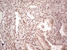 NR5A1 / SF1 Antibody - Immunohistochemical staining of paraffin-embedded Human endometrium tissue within the normal limits using anti-NR5A1 mouse monoclonal antibody. (Heat-induced epitope retrieval by 1 mM EDTA in 10mM Tris, pH8.5, 120C for 3min,