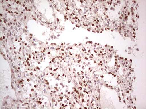 NR5A1 / SF1 Antibody - Immunohistochemical staining of paraffin-embedded Human lymph node tissue within the normal limits using anti-NR5A1 mouse monoclonal antibody. (Heat-induced epitope retrieval by 1 mM EDTA in 10mM Tris, pH8.5, 120C for 3min,
