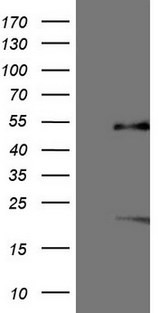 NR5A1 / SF1 Antibody - HEK293T cells were transfected with the pCMV6-ENTRY control (Left lane) or pCMV6-ENTRY NR5A1 (Right lane) cDNA for 48 hrs and lysed. Equivalent amounts of cell lysates (5 ug per lane) were separated by SDS-PAGE and immunoblotted with anti-NR5A1.