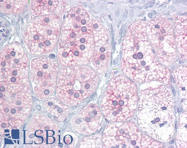 NR5A1 / SF1 Antibody - Anti-NR5A1 antibody IHC of human adrenal. Immunohistochemistry of formalin-fixed, paraffin-embedded tissue after heat-induced antigen retrieval. Antibody concentration 10 ug/ml.  This image was taken for the unconjugated form of this product. Other forms have not been tested.