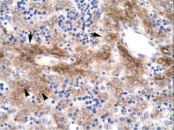 NR5A1 / SF1 Antibody - NR5A1 antibody ARP31834_P050-NP_004950-NR5A1 (nuclear receptor subfamily 5, group A, member 1) Antibody was used in IHC to stain formalin-fixed, paraffin-embedded human liver.  This image was taken for the unconjugated form of this product. Other forms have not been tested.