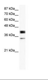 NR5A1 / SF1 Antibody - Daudi Cell Lysate.  This image was taken for the unconjugated form of this product. Other forms have not been tested.
