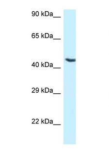 NR5A1 / SF1 Antibody - NR5A1 antibody Western blot of HepG2 Cell lysate. Antibody concentration 1 ug/ml.  This image was taken for the unconjugated form of this product. Other forms have not been tested.