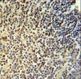 NR5A1 / SF1 Antibody - NR5A1 Antibody IHC of formalin-fixed and paraffin-embedded human spleen tissue followed by peroxidase-conjugated secondary antibody and DAB staining.