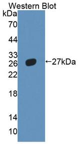 NR5A2 / LRH-1 Antibody - Western blot of NR5A2 / LRH-1 antibody.