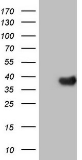 NR5A2 / LRH-1 Antibody - Human recombinant protein fragment corresponding to amino acids 1-303 of human NR5A2(NP_995582) produced in E.coli.