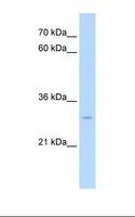 NR5A2 / LRH-1 Antibody - HepG2 cell lysate. Antibody concentration: 1.0 ug/ml. Gel concentration: 12%.  This image was taken for the unconjugated form of this product. Other forms have not been tested.