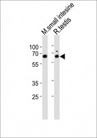 NR5A2 / LRH-1 Antibody - All lanes : Anti-Nr5a2 Antibody at 1:1000 dilution Lane 1: mouse small intestine lysates Lane 2: rat testis lysates Lysates/proteins at 20 ug per lane. Secondary Goat Anti-Rabbit IgG, (H+L), Peroxidase conjugated at 1/10000 dilution Predicted band size : 64 kDa Blocking/Dilution buffer: 5% NFDM/TBST.