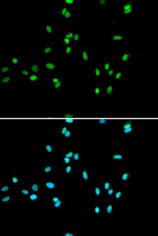 NR5A2 / LRH-1 Antibody - Immunofluorescence analysis of A549 cells.