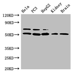 NR5A2 / LRH-1 Antibody - Positive WB detected in:Hela whole cell lysate,PC3 whole cell lysate,HepG2 whole cell lysate,Mouse kidney tissue,Mouse brain tissue;All lanes:NR5A2 antibody at 3?g/ml;Secondary;Goat polyclonal to rabbit IgG at 1/50000 dilution;Predicted band size: 62,57,43,54 KDa;Observed band size: 62,54 KDa;