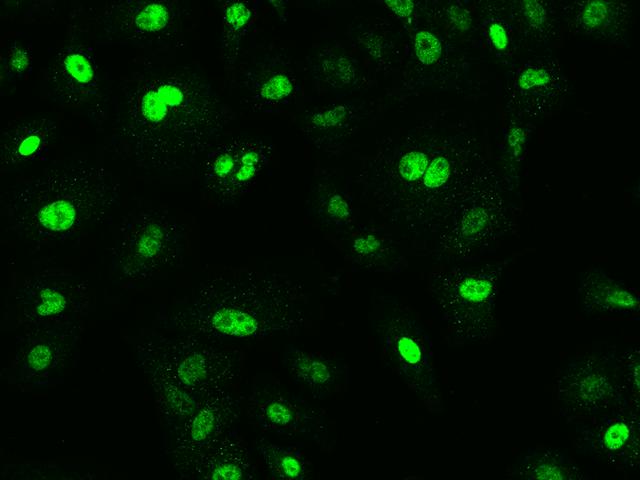 NR5A2 / LRH-1 Antibody - Immunofluorescence staining of NR5A2 in A549 cells. Cells were fixed with 4% PFA, permeabilzed with 0.1% Triton X-100 in PBS, blocked with 10% serum, and incubated with rabbit anti-Human NR5A2 polyclonal antibody (dilution ratio 1:200) at 4°C overnight. Then cells were stained with the Alexa Fluor 488-conjugated Goat Anti-rabbit IgG secondary antibody (green). Positive staining was localized to Nucleus.