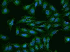 NR5A2 / LRH-1 Antibody - Immunofluorescence staining of P2RX5 in U2OS cells. Cells were fixed with 4% PFA, permeabilzed with 0.1% Triton X-100 in PBS, blocked with 10% serum, and incubated with rabbit anti-Human P2RX5 polyclonal antibody (dilution ratio 1:200) at 4°C overnight. Then cells were stained with the Alexa Fluor 488-conjugated Goat Anti-rabbit IgG secondary antibody (green) and counterstained with DAPI (blue). Positive staining was localized to Cytoplasm and cell membrane.