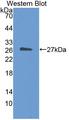 NR6A1 / GCNF Antibody - Western blot of NR6A1 / GCNF antibody.