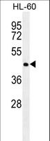 NR6A1 / GCNF Antibody - NR6A1 Antibody western blot of HL-60 cell line lysates (35 ug/lane). The NR6A1 antibody detected the NR6A1 protein (arrow).