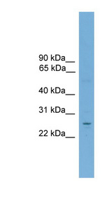 NR6A1 / GCNF Antibody - NR6A1 / GCNF antibody Western blot of THP-1 cell lysate. This image was taken for the unconjugated form of this product. Other forms have not been tested.