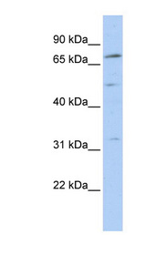 NR6A1 / GCNF Antibody - NR6A1 / GCNF antibody Western blot of MCF7 cell lysate. This image was taken for the unconjugated form of this product. Other forms have not been tested.