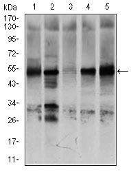 NR6A1 / GCNF Antibody - Western blot using NR6A1 mouse monoclonal antibody against K562 (1), NTERA-2 (2), HEK293 (3), HUVE-12 (4), and HeLa (5) cell lysate.