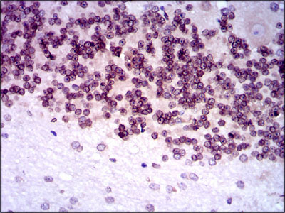 NR6A1 / GCNF Antibody - IHC of paraffin-embedded cerebellum tissues using NR6A1 mouse monoclonal antibody with DAB staining.