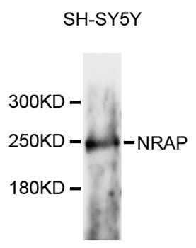 NRAP Antibody - Western blot analysis of extracts of SH-SY5Y cells, using NRAP antibody at 1:3000 dilution. The secondary antibody used was an HRP Goat Anti-Rabbit IgG (H+L) at 1:10000 dilution. Lysates were loaded 25ug per lane and 3% nonfat dry milk in TBST was used for blocking. An ECL Kit was used for detection and the exposure time was 30s.