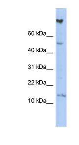 NRARP Antibody - NRARP antibody Western blot of HepG2 cell lysate. This image was taken for the unconjugated form of this product. Other forms have not been tested.