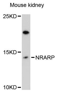 NRARP Antibody - Western blot analysis of extracts of mouse kidney, using NRARP antibody at 1:3000 dilution. The secondary antibody used was an HRP Goat Anti-Rabbit IgG (H+L) at 1:10000 dilution. Lysates were loaded 25ug per lane and 3% nonfat dry milk in TBST was used for blocking. An ECL Kit was used for detection and the exposure time was 90s.
