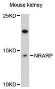 NRARP Antibody - Western blot analysis of extracts of mouse kidney, using NRARP antibody at 1:3000 dilution. The secondary antibody used was an HRP Goat Anti-Rabbit IgG (H+L) at 1:10000 dilution. Lysates were loaded 25ug per lane and 3% nonfat dry milk in TBST was used for blocking. An ECL Kit was used for detection and the exposure time was 90s.