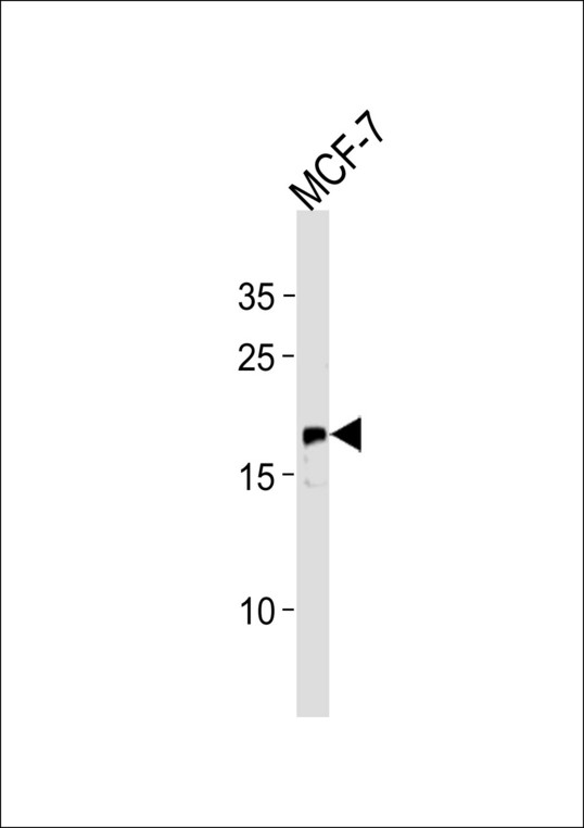 NRAS / N-ras Antibody - NRAS Antibody western blot of MCF-7 cell line lysates (35 ug/lane). The NRAS antibody detected the NRAS protein (arrow).
