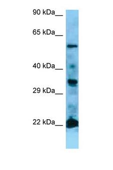 NRAS / N-ras Antibody - NRAS antibody Western blot of Jurkat Cell lysate. Antibody concentration 1 ug/ml. This image was taken for the unconjugated form of this product. Other forms have not been tested.