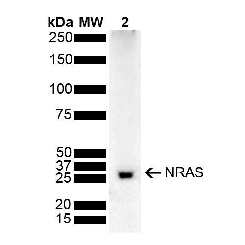 NRAS / N-ras Antibody - Western blot analysis of Rat Kidney showing detection of 21.2 kDa NRAS protein using Rabbit Anti-NRAS Polyclonal Antibody. Lane 1: Molecular Weight Ladder (MW). Lane 2: Rat Kidney. Load: 15 µg. Block: 5% Skim Milk powder in TBST. Primary Antibody: Rabbit Anti-NRAS Polyclonal Antibody  at 1:1000 for 2 hours at RT with shaking. Secondary Antibody: Goat Anti-Rabbit IgG: HRP at 1:5000 for 1 hour at RT. Color Development: ECL solution for 5 min at RT. Predicted/Observed Size: 21.2 kDa. Other Band(s): 25 kDa.