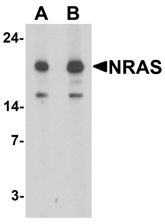 NRAS / N-ras Antibody - Western blot analysis of N-RAS in 293 cell lysate with N-RAS antibody at (A) 1 and (B) 2 ug/ml.