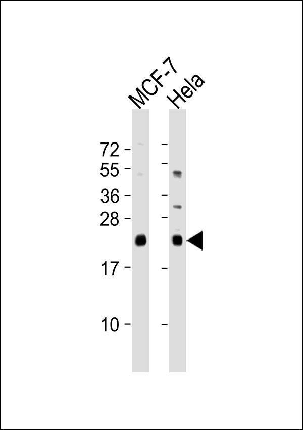 NRAS / N-ras Antibody - All lanes : Anti-NRAS/HRAS/KRAS Antibody at 1:1000 dilution Lane 1: MCF-7 whole cell lysates Lane 2: HeLa whole cell lysates Lysates/proteins at 20 ug per lane. Secondary Goat Anti-Rabbit IgG, (H+L),Peroxidase conjugated at 1/10000 dilution Predicted band size : 21 kDa Blocking/Dilution buffer: 5% NFDM/TBST.