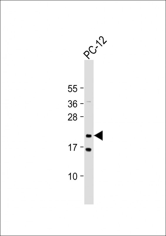 NRAS / N-ras Antibody - Anti-NRAS Antibody at 1:2000 dilution + PC-12 whole cell lysate Lysates/proteins at 20 µg per lane. Secondary Goat Anti-Rabbit IgG, (H+L), Peroxidase conjugated at 1/10000 dilution. Predicted band size: 21 kDa Blocking/Dilution buffer: 5% NFDM/TBST.