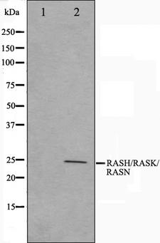 NRAS / N-ras Antibody - Western blot analysis on HeLa cell lysates using RASH/RASK/RASN antibody. The lane on the left is treated with the antigen-specific peptide.