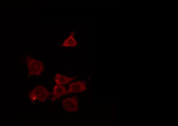NRAS / N-ras Antibody - Staining HeLa cells by IF/ICC. The samples were fixed with PFA and permeabilized in 0.1% Triton X-100, then blocked in 10% serum for 45 min at 25°C. The primary antibody was diluted at 1:200 and incubated with the sample for 1 hour at 37°C. An Alexa Fluor 594 conjugated goat anti-rabbit IgG (H+L) Ab, diluted at 1/600, was used as the secondary antibody.