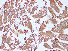 NRAS / N-ras Antibody - Immunohistochemistry of paraffin-embedded Human duodenum using NRAS Polyclonal Antibody at dilution of 1:100(100×).