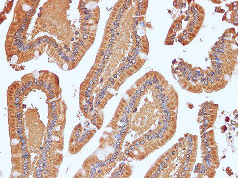 NRAS / N-ras Antibody - Immunohistochemistry of paraffin-embedded Human duodenum using NRAS Polyclonal Antibody at dilution of 1:100(400×).
