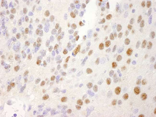 NRBF2 Antibody - Detection of Mouse NRBF2 by Immunohistochemistry. Sample: FFPE section of mouse teratoma. Antibody: Affinity purified rabbit anti-NRBF2 used at a dilution of 1:250.
