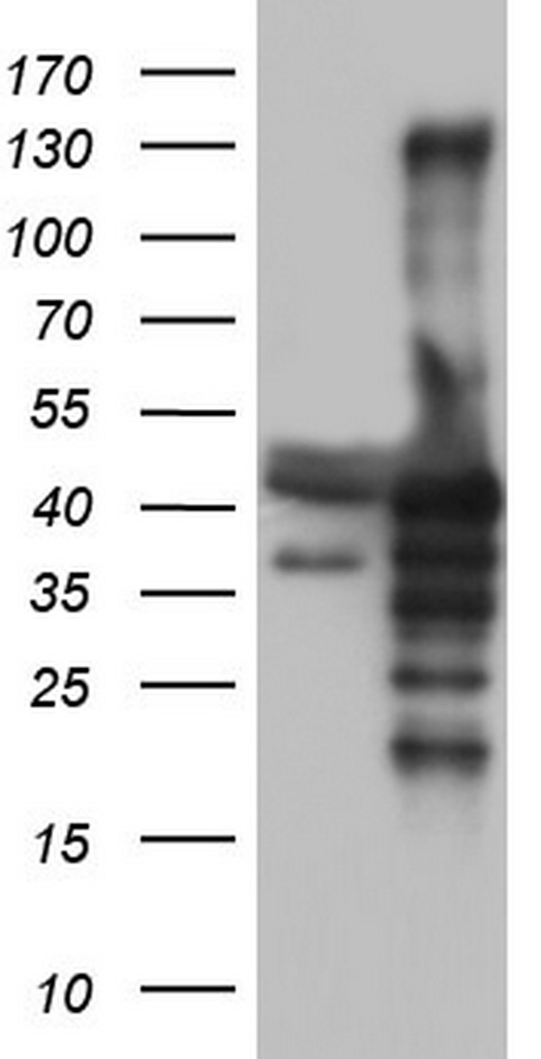 NRBF2 Antibody - HEK293T cells were transfected with the pCMV6-ENTRY control (Left lane) or pCMV6-ENTRY NRBF2 (Right lane) cDNA for 48 hrs and lysed. Equivalent amounts of cell lysates (5 ug per lane) were separated by SDS-PAGE and immunoblotted with anti-NRBF2.