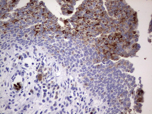 NRBF2 Antibody - IHC of paraffin-embedded Human bladder tissue using anti-NRBF2 mouse monoclonal antibody. (Heat-induced epitope retrieval by 1 mM EDTA in 10mM Tris, pH8.5, 120°C for 3min).