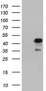 NRBF2 Antibody - HEK293T cells were transfected with the pCMV6-ENTRY control (Left lane) or pCMV6-ENTRY NRBF2 (Right lane) cDNA for 48 hrs and lysed. Equivalent amounts of cell lysates (5 ug per lane) were separated by SDS-PAGE and immunoblotted with anti-NRBF2.