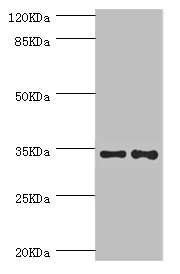 NRBF2 Antibody - Western blot All Lanes:NRBF2 antibody at 5.51ug/ml Lane 1:HepG2 whole cell lysate Lane 2:A549 whole cell lysate Secondary Goat polyclonal to rabbit at 1/10000 dilution Predicted band size: 33,27,32 kDa Observed band size: 32 kDa