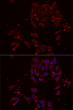 NRBF2 Antibody - Immunofluorescence analysis of MCF7 cells using NRBF2 antibody. Blue: DAPI for nuclear staining.